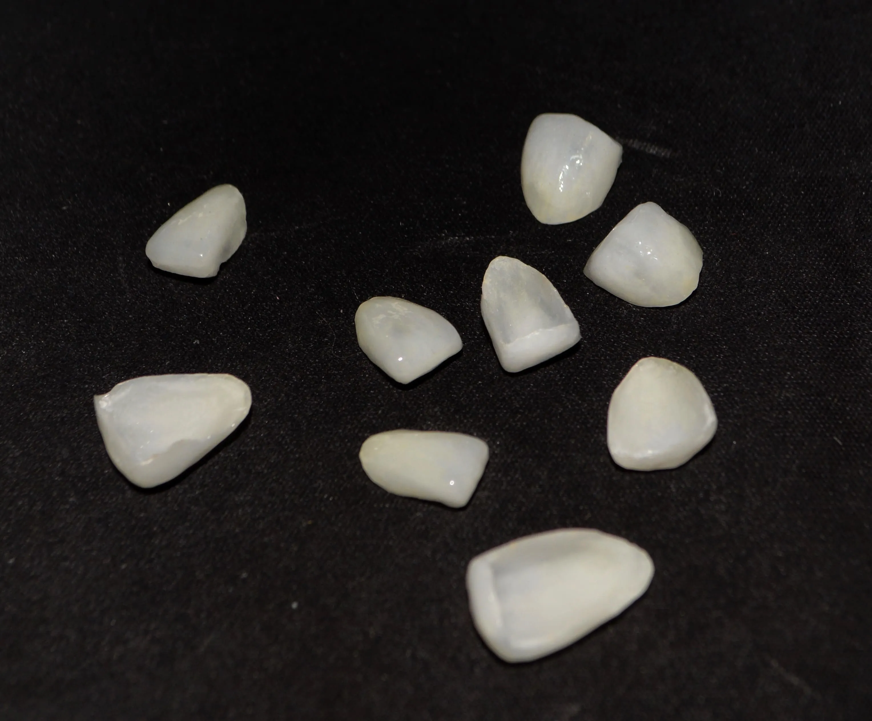 Precios de carillas dentales