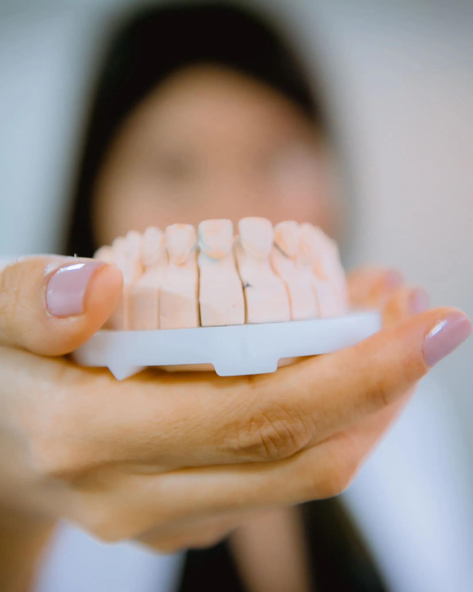 Prótesis sobre implantes