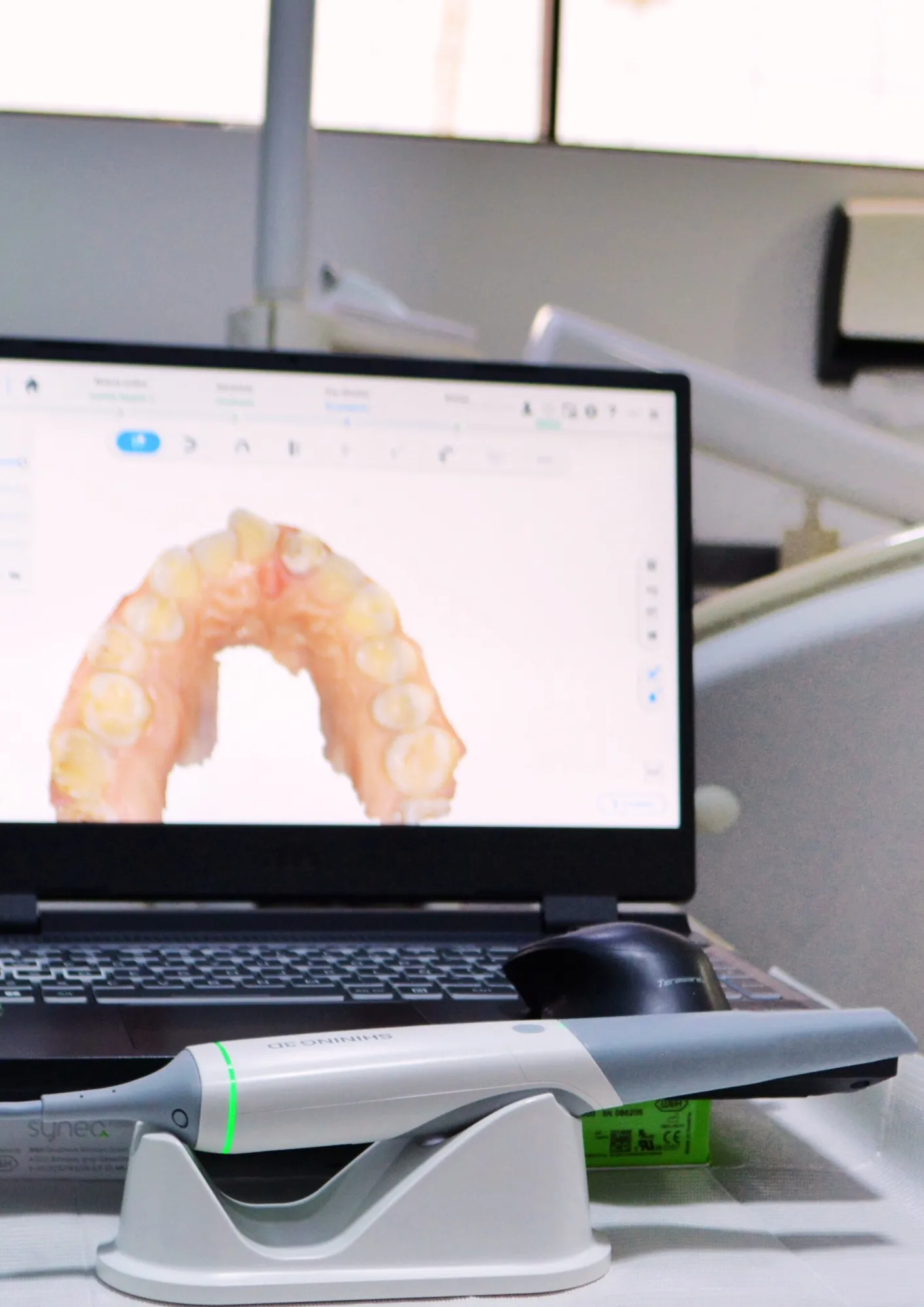 Tratamiento de rehabilitación oral - Implantes dentales