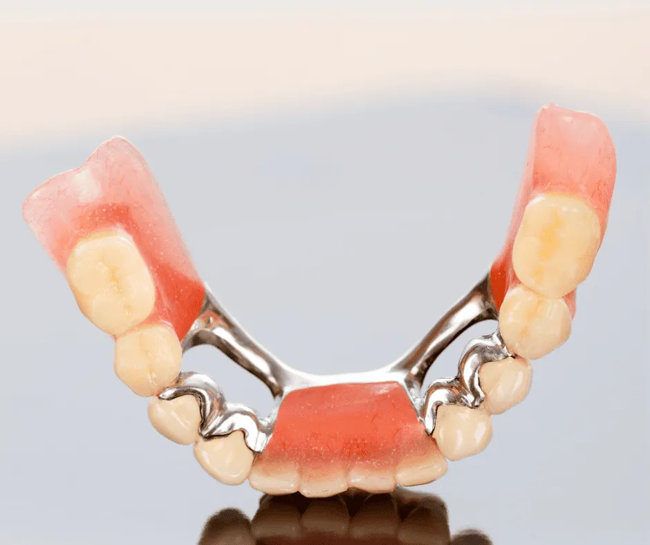 Prótesis parciales removibles